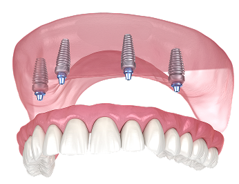 Teeth images