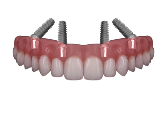 Teeth images
